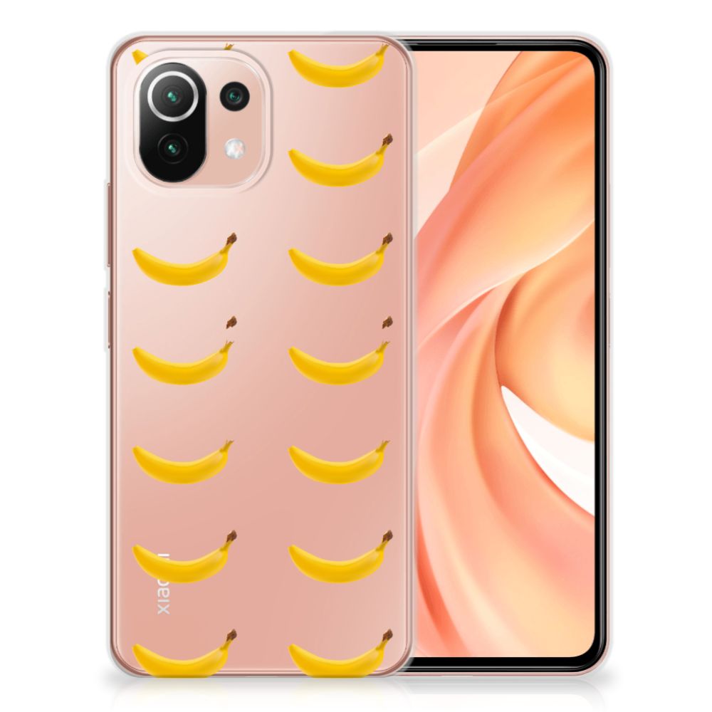 Xiaomi Mi 11 Lite | 11 Lite 5G NE Siliconen Case Banana